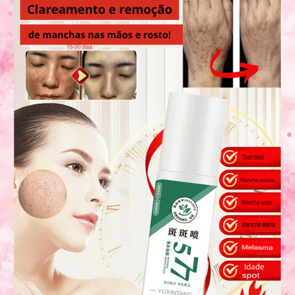 Spray 577  Clareador de Manchas de Sol, Idade e Melasma + Frete GRÁTIS!