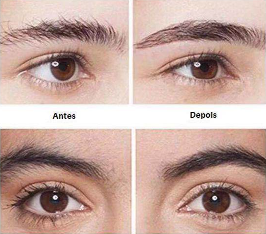 Caneta Depiladora