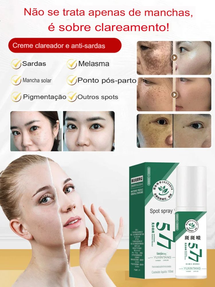 Spray 577  Clareador de Manchas de Sol, Idade e Melasma + Frete GRÁTIS!
